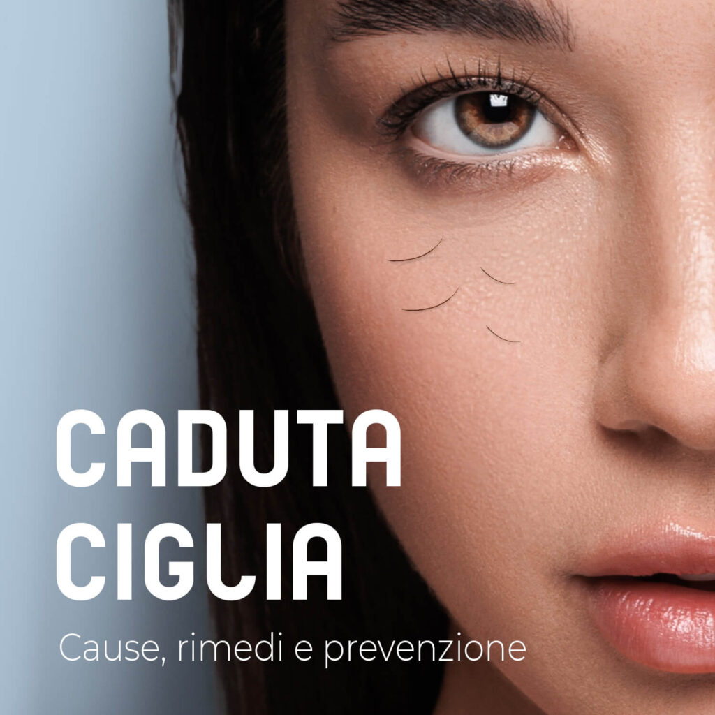 caduta ciglia cause rimedi prevenzione