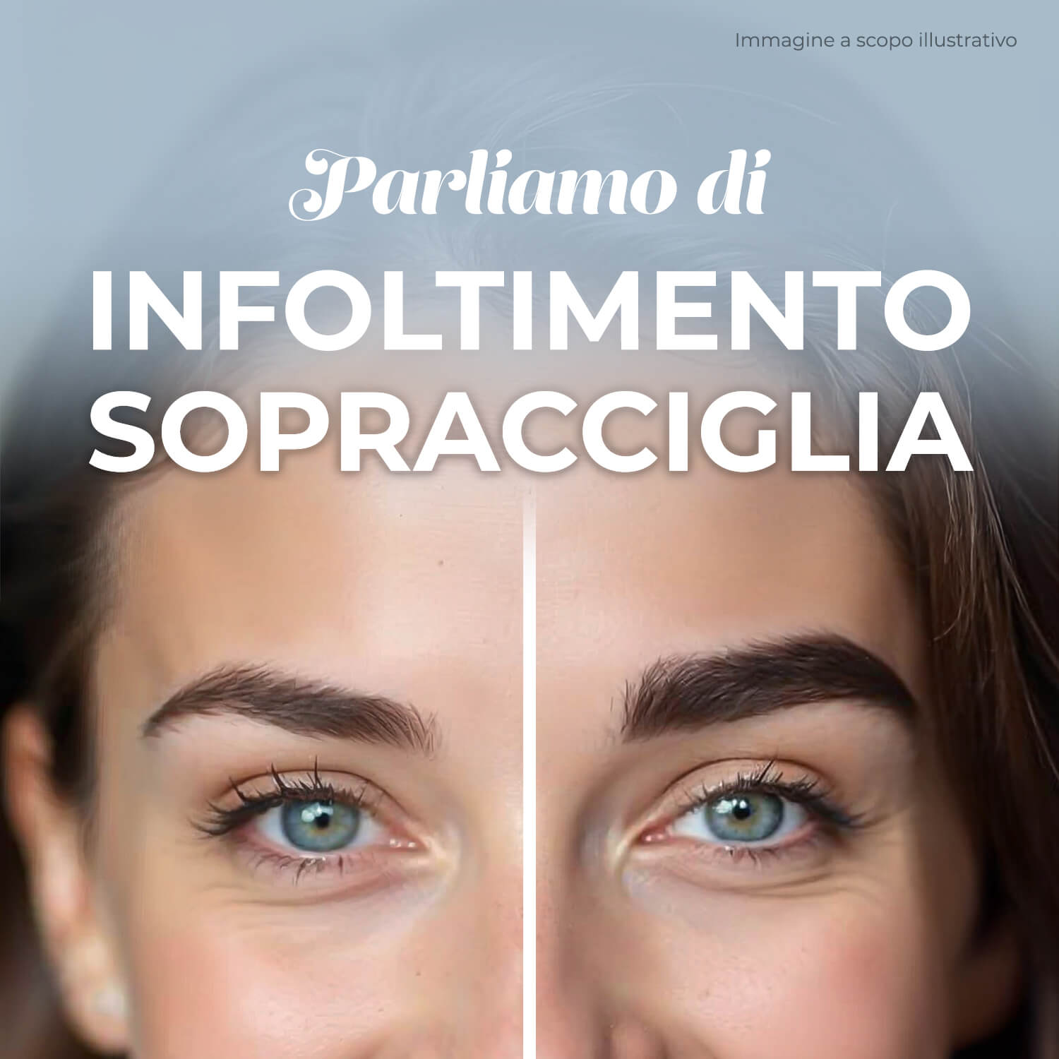 parliamo di Infoltimento Sopracciglia nel blog di my lamination